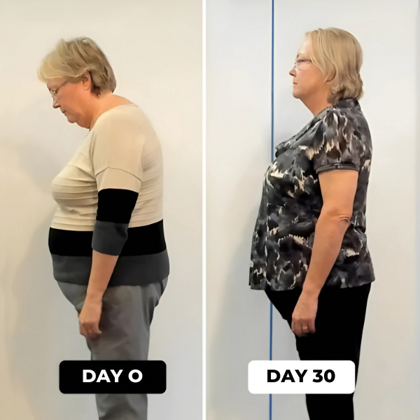 SpineAlign™ Posture Corrector | Instant Posture Correction - Inventifyco