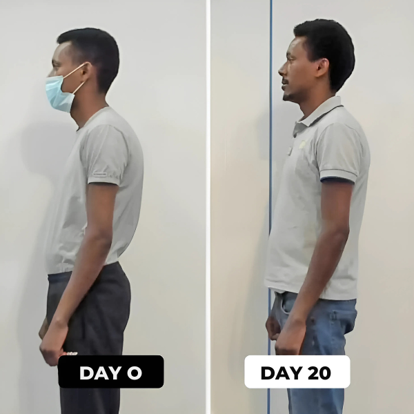 SpineAlign™ Posture Corrector | Instant Posture Correction - Inventifyco
